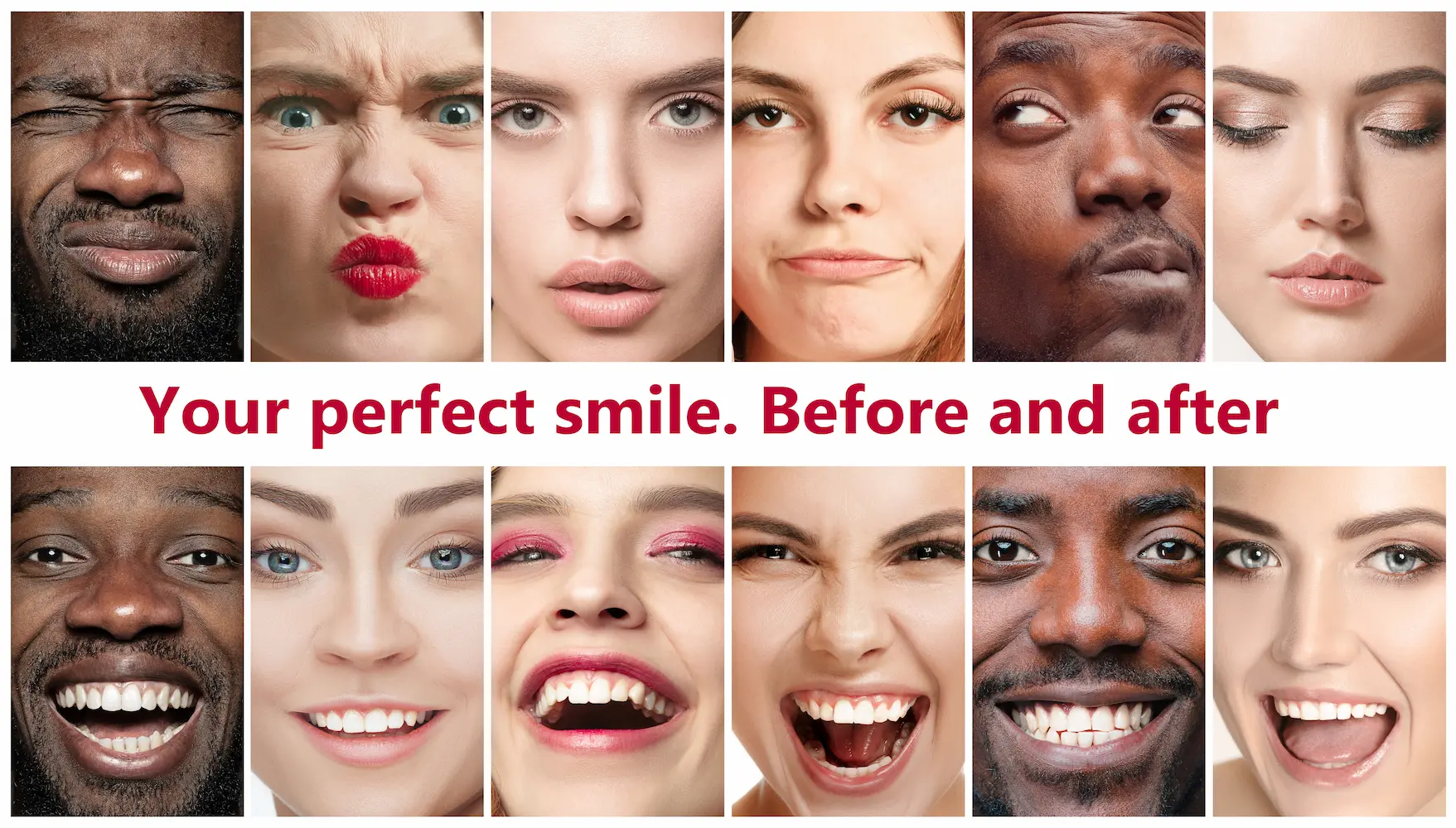 Before and after smile transformations at Monteluz Dental Specialty Group