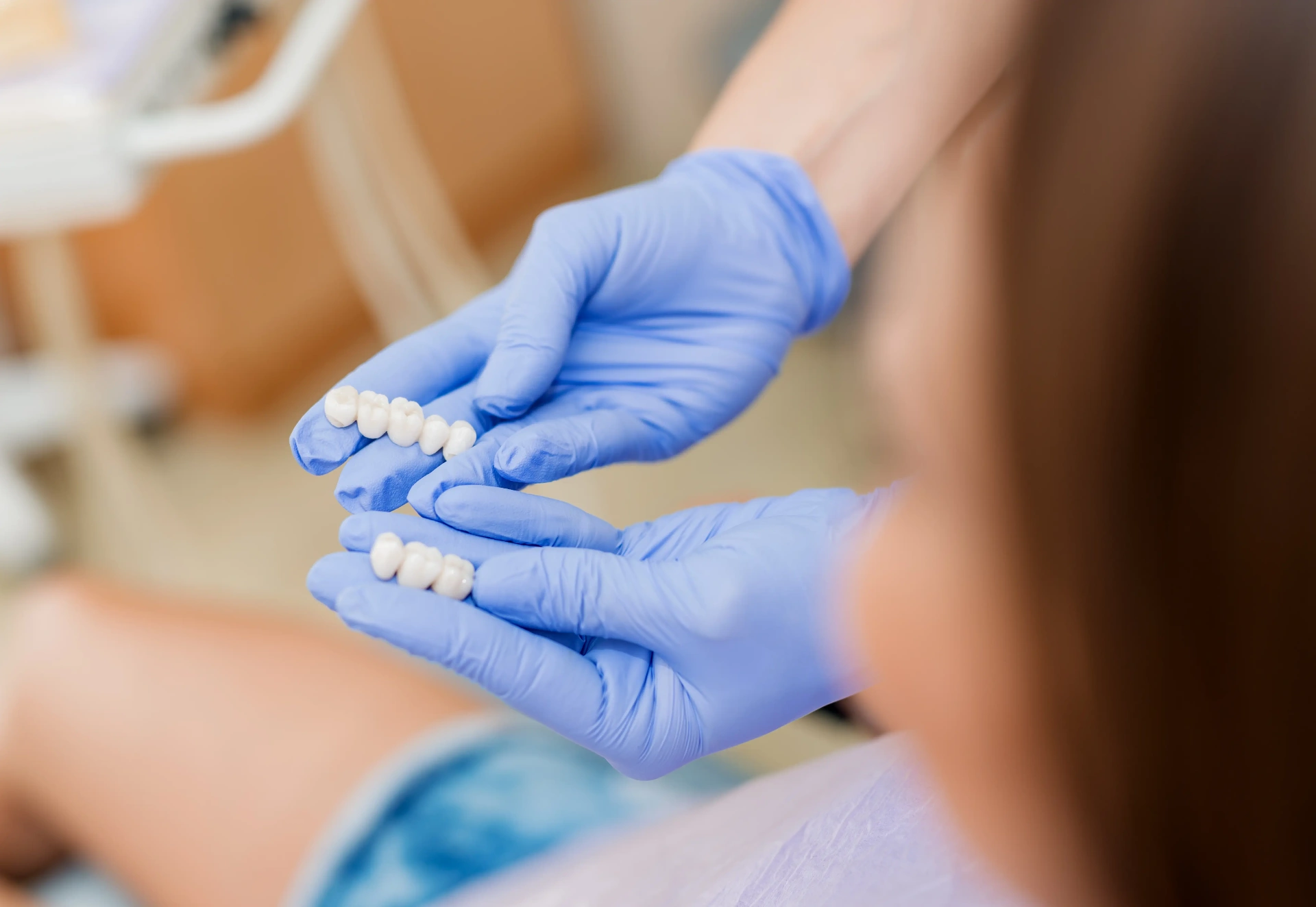 Dental Crowns