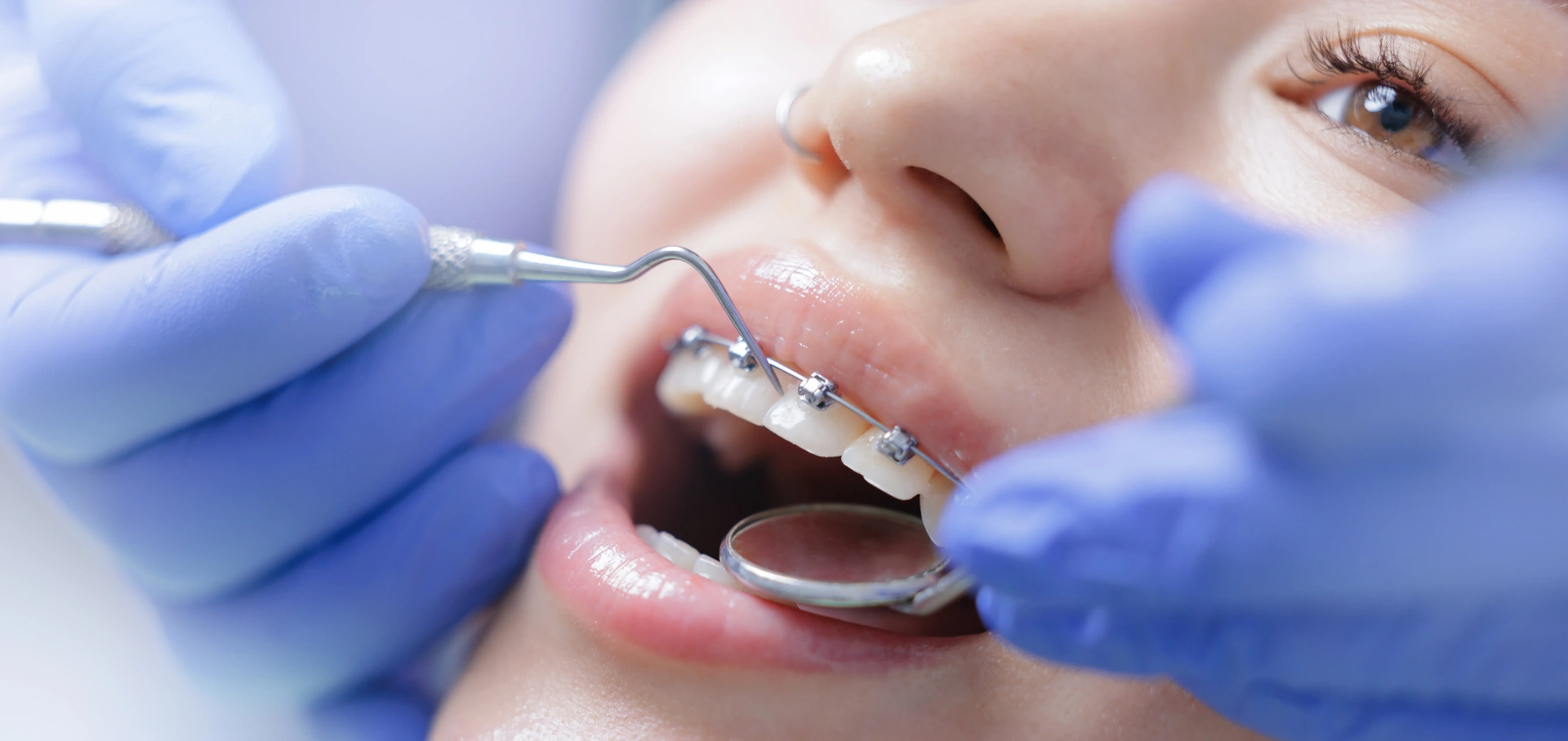 Orthodontics (Braces & Aligners)