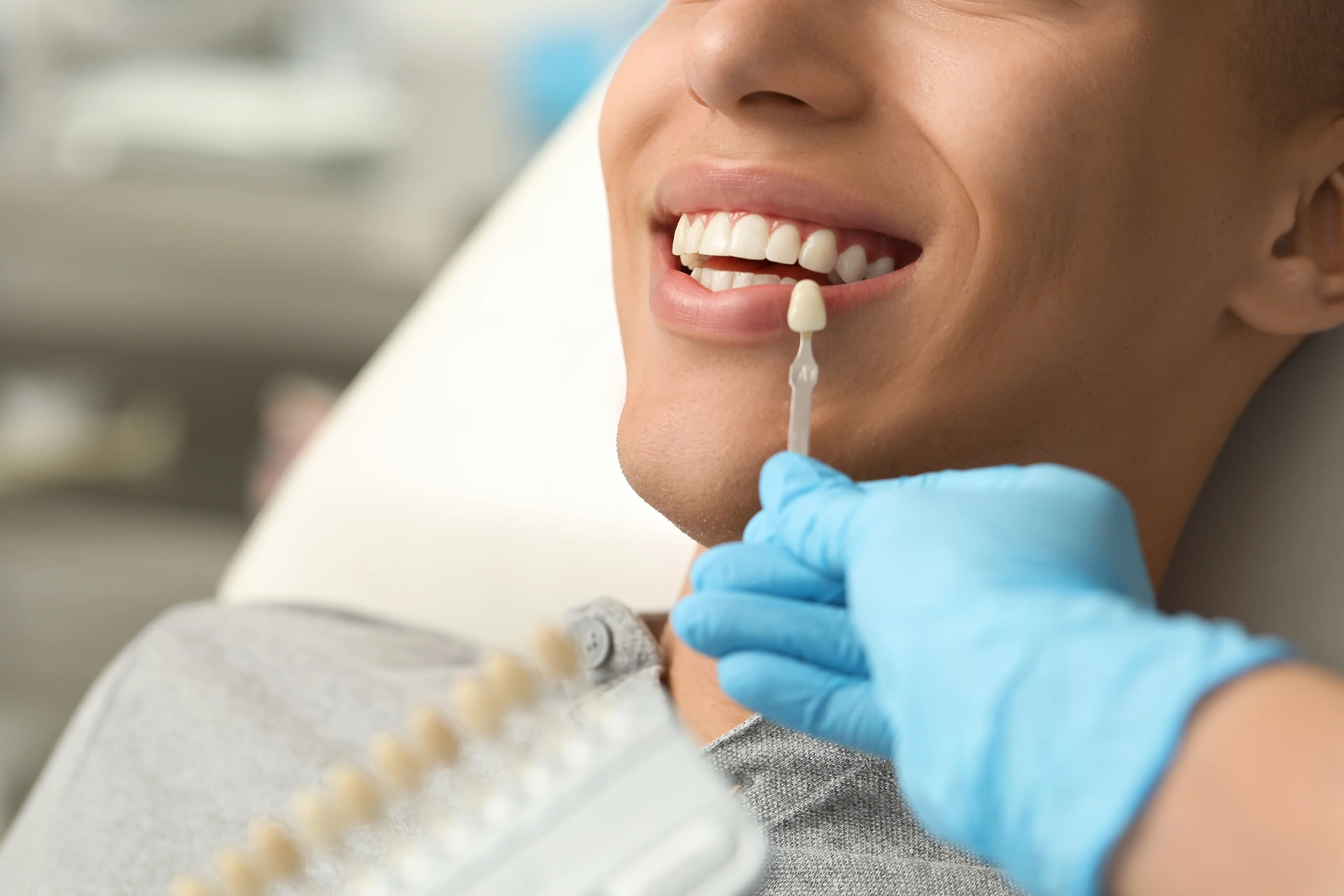 Dental Veneers